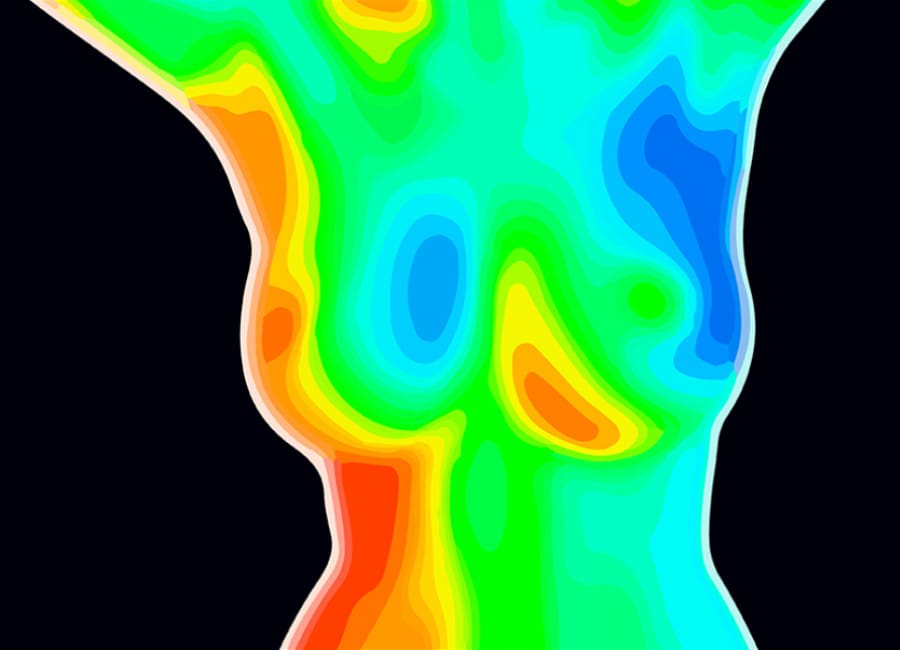 breast thermography